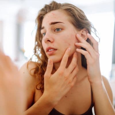 Allergies alimentaires : quels effets sur la peau ?