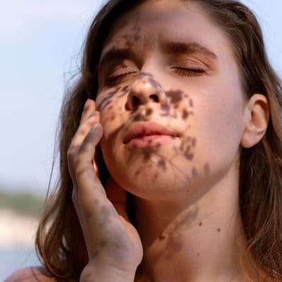 Lentigos, mélasma, HPI : comment différencier les taches pigmentaires et les traiter efficacement