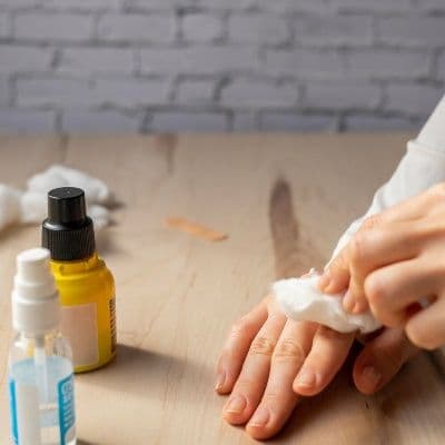 Mains irritées ou abîmées : les bons réflexes pour soigner une dermatite de contact