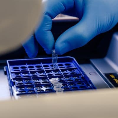 Méthylation de l'ADN : le chef d'orchestre silencieux de notre génétique