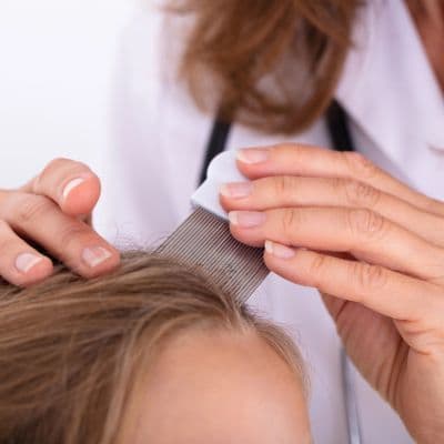Lentes : comment les éliminer efficacement