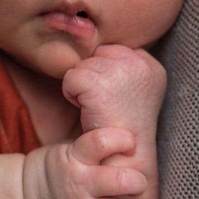 Comment différencier les boutons de chaleur chez le bébé d'une dermatite atopique ?