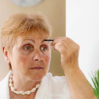 Alopécie fibrosante frontale : pourquoi les sourcils tombent-ils en premier ?