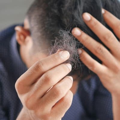 Follicule pileux : qu’est-ce que c’est, comment fonctionne-t-il et pourquoi peut-il dysfonctionner ?