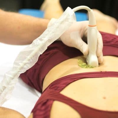 Douleur au point de McBurney : comment reconnaître une appendicite